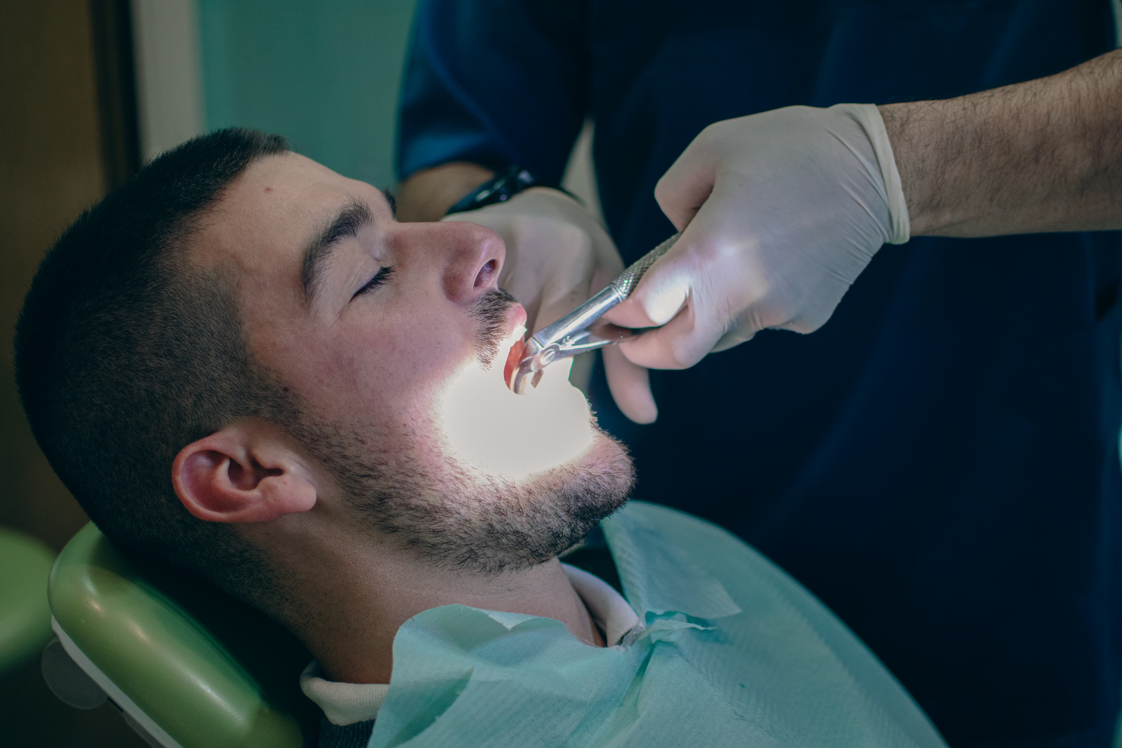 Surgical Dental Extraction